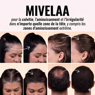 MIVELAA Poudre Compacte Capillaire — Couverture Instantanée